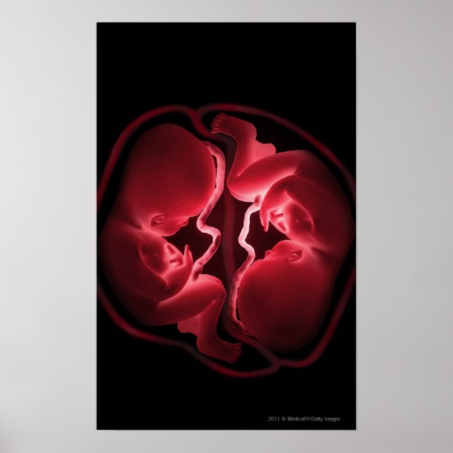Konceptuell bild av livmoder som innehåller twilli poster (Framsidan)