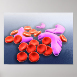 Konceptuell bild av sicklecellanemi poster