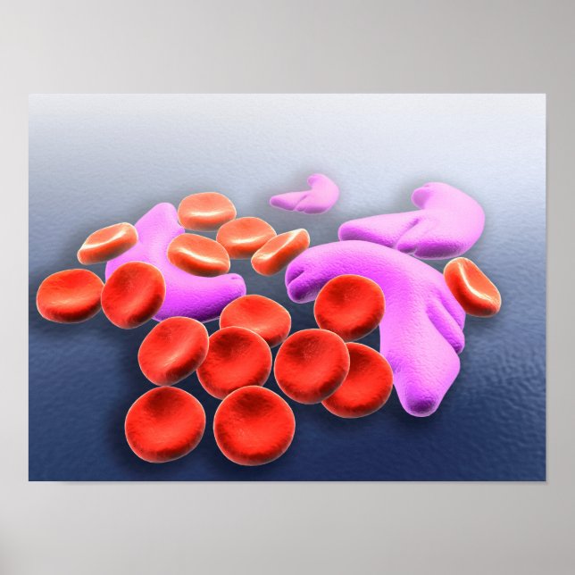Konceptuell bild av sicklecellanemi poster (Framsidan)