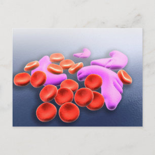 Konceptuell bild av sicklecellanemi vykort