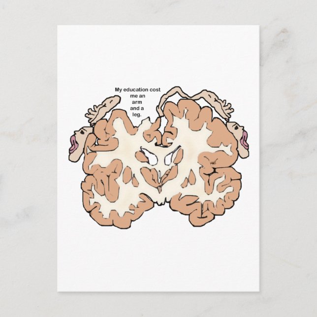 Kostnad för arm och en bensomunculus vykort (Framsida)