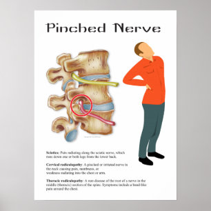 Kretchdiagram för nykapad nervös fysisk terapi poster