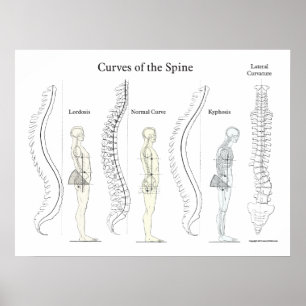 Kurvor i ryggraden Poster kiropraktik