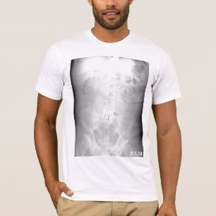 L-5/S1 CT Bildläsning-initialed-vid KLM Tee Shirt