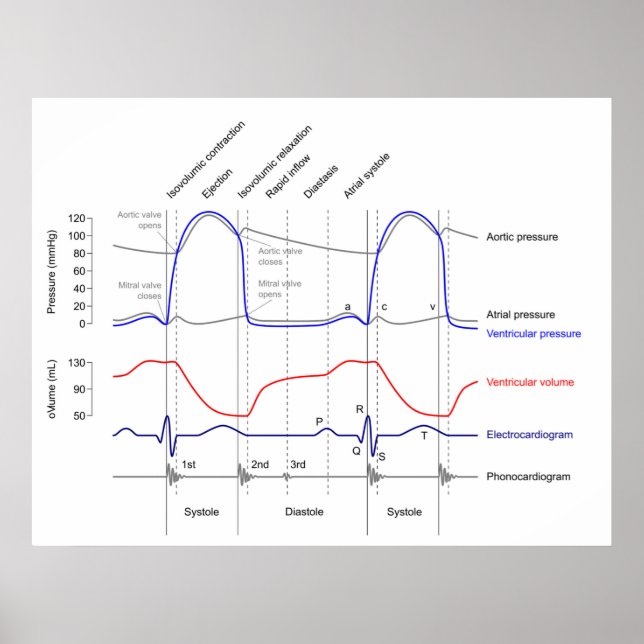 Lämnat venturirör Diagram - kardicykelhändelser Poster (Framsidan)