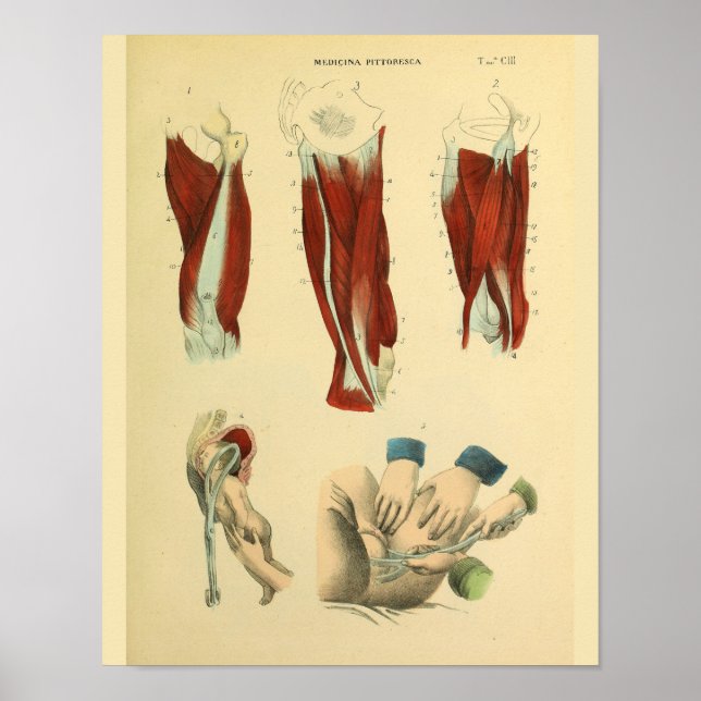 Lårmuskler Bird Forceps Anatomy Art Print Poster (Framsidan)