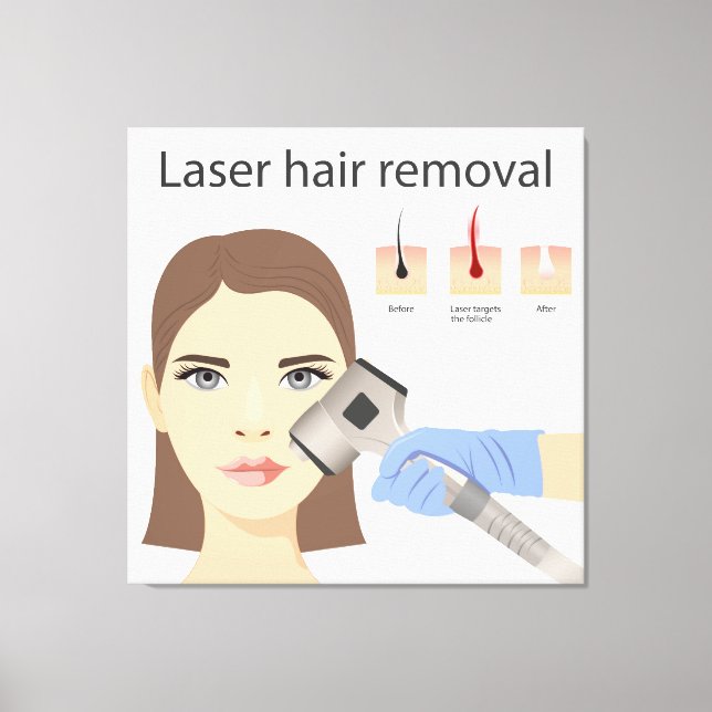 Laserhårborttagningsstruktur Canvastryck (Framsida)