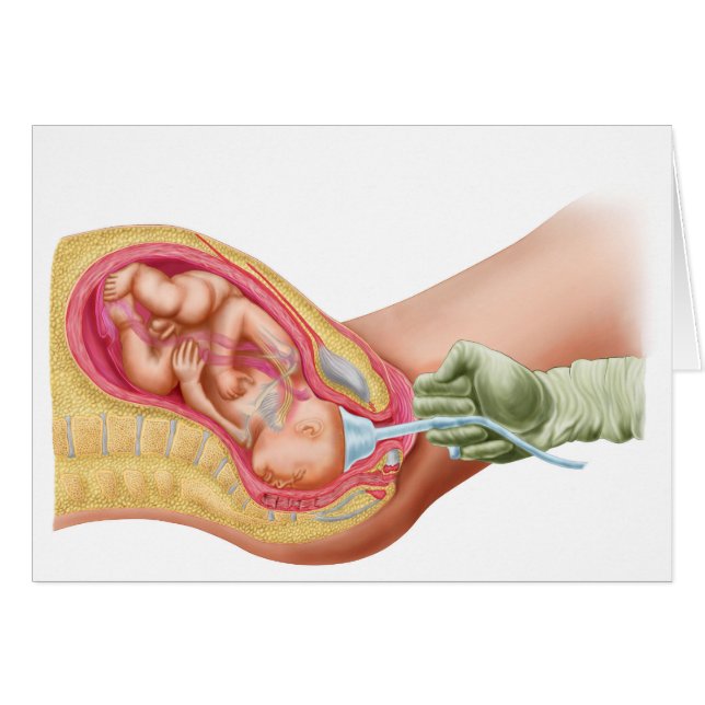 Leverans av bränsle med hjälp av vakuumextraktion hälsningskort (Framsidan Horizontal)