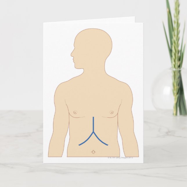 Levertransplantation Kort (Framsida)