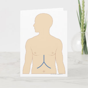 Levertransplantation Kort