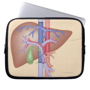Levertransplantattillvägagångssätt Laptop Sleeve
