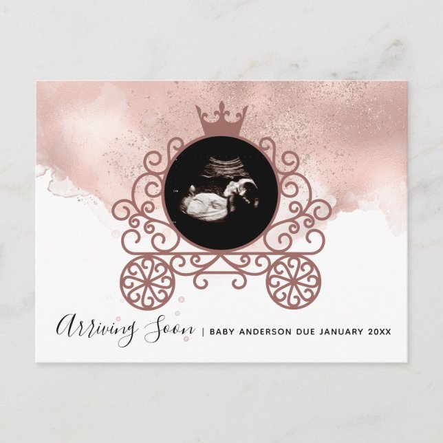 Lilla Princess Sonogram Gravid Announcement Helg Vykort (Framsida)