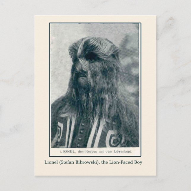 Lionel, det Lejona ansiktet på pojkkort och vykort (Framsida)
