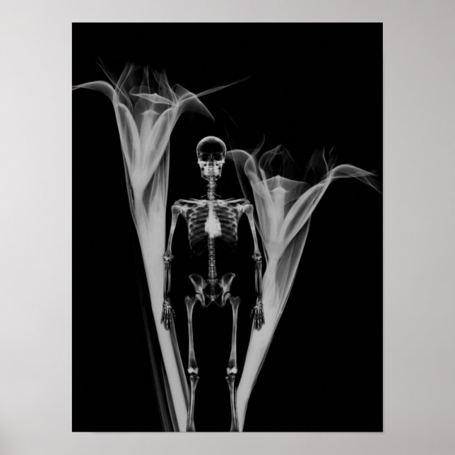 Little Human X-Ray Skeleton & Flowers - B&W Poster (Framsidan)