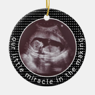 Little Miracle in Skapar Photo Ultrasound Sonogram Julgransprydnad Keramik