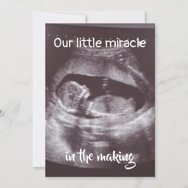 Little Miracle Ultrasound 2 Photo Baby-familjen Meddelande (Framsida)