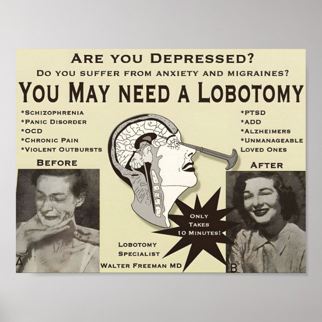 Lobotomy Advertising Poster | VINTAGE ANNONS | (Framsidan)
