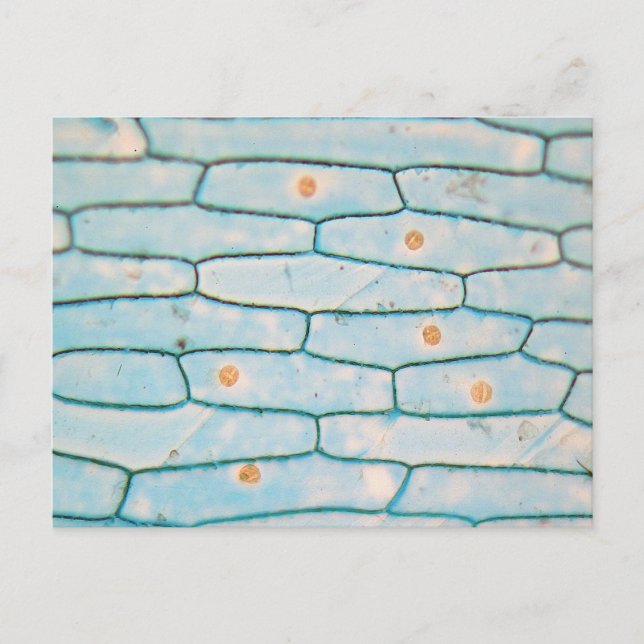 Lök under mikroskop vykort (Framsida)