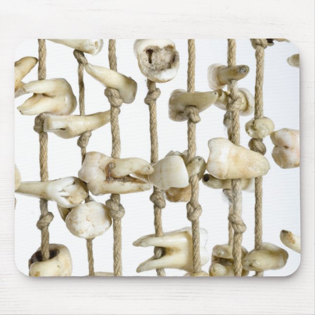 Lönsam tandfotografi extraherad tjugontanddentist musmatta (Framsidan)