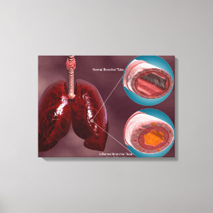 Luftstrupetvärsnitt med Lungs Canvastryck