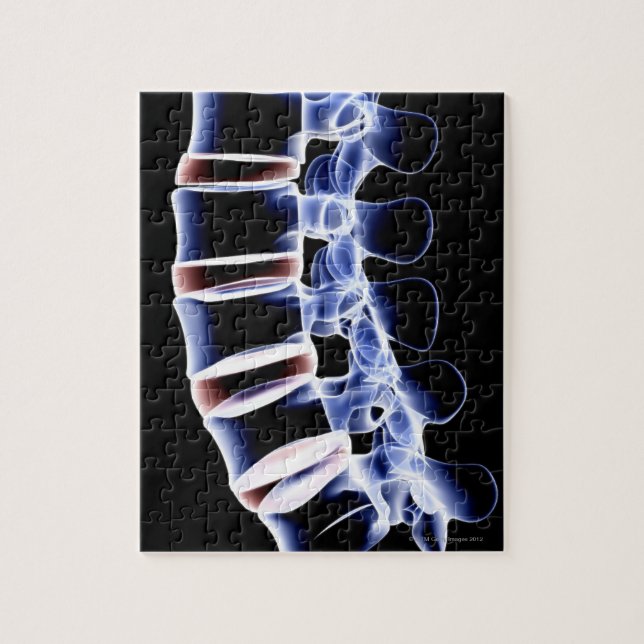 Lumbar Vertebrae 2 Pussel (Vertikal)