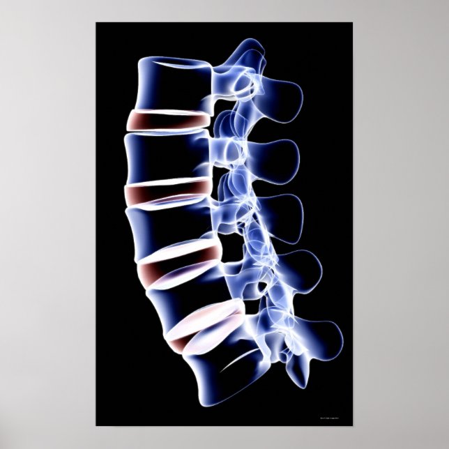 Lumbar Vertebrae Poster (Framsidan)
