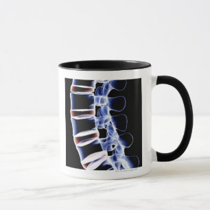 Lumbarkotor 2 mugg