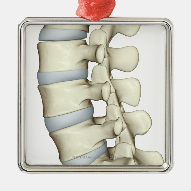 Lumbarkotor Julgransprydnad Metall (Framsidan)