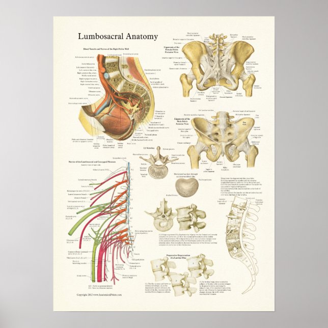 Lumbosacral Anatomy Poster och ryggdegenerering (Framsidan)