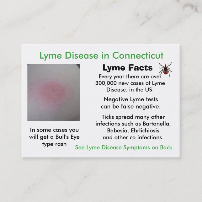 Lyme Disease in Connecticut Information Cards Visitkort (Framsida)