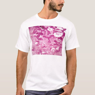 Lymfaknutpunktceller under mikroskopet tee