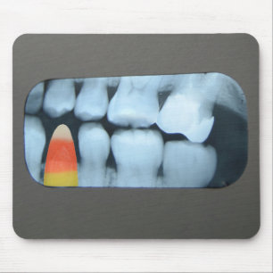 Maj Candy i Xray Musmatta