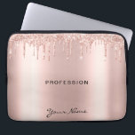 Makeup Artist Eyelash Lash Glitter Drives Ro Laptop Fodral<br><div class="desc">Trendig Glitter Ro guld droppar Lash-skriptet Ro Guld Laptop sleeve. Fabulous Makeup Artist Eyelash Utformning med skriptkalligraftext, ro guld droppar glitter och öga-infångande slank bakgrund. Anpassningsbar den här feminina laptop sleeve-designen som lägger till ditt namn, ditt yrke, välj ett eget skriptteckensnitt, ändra eller ta bort valfritt inslag. Makeup Artist Eyelash...</div>