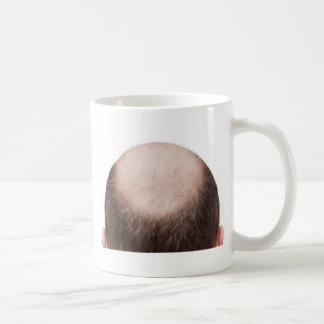 Male Mönster Balness Kaffemugg