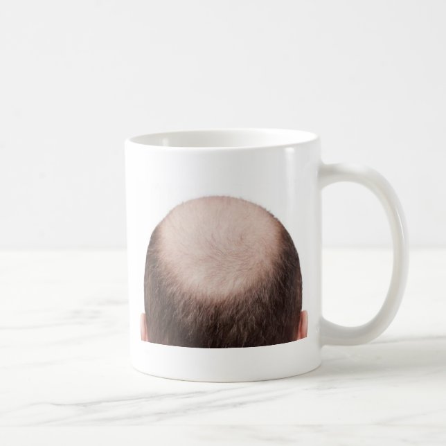 Male Mönster Balness Kaffemugg (Höger)
