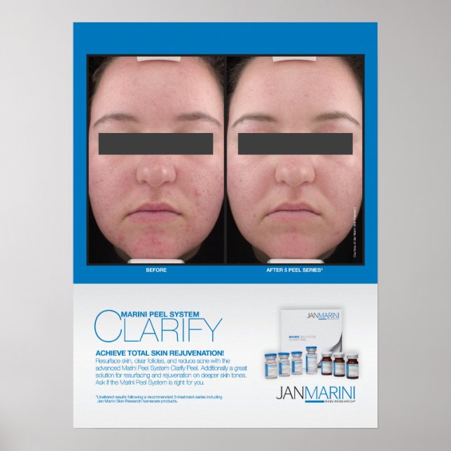 Marini Peel Klargör resultat 18 x 24 tum Poster (Framsidan)