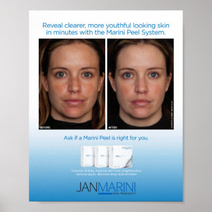 Marini Peel System 8 x 10 tum Poster