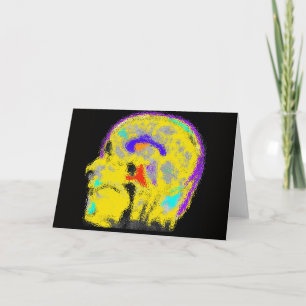 Marks färgade MRI Kort
