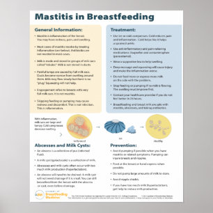 Mastit i amning Poster (engelska)