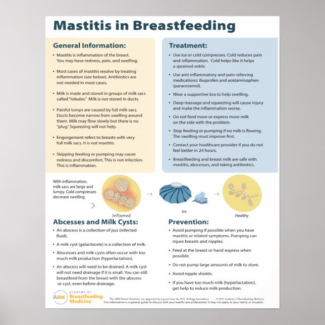 Mastit i amning Poster (engelska) (Framsidan)
