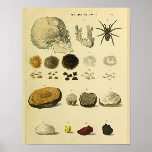 Medicinsk anatomi Art Skriv ut med mänsklig hullsp Poster (Framsidan)