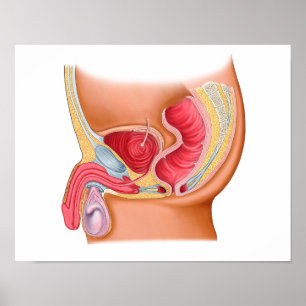 Medicinsk illustration av en Rectourethral Fistula Poster