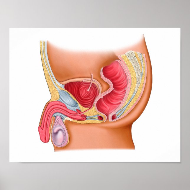 Medicinsk illustration av en Rectourethral Fistula Poster (Framsidan)