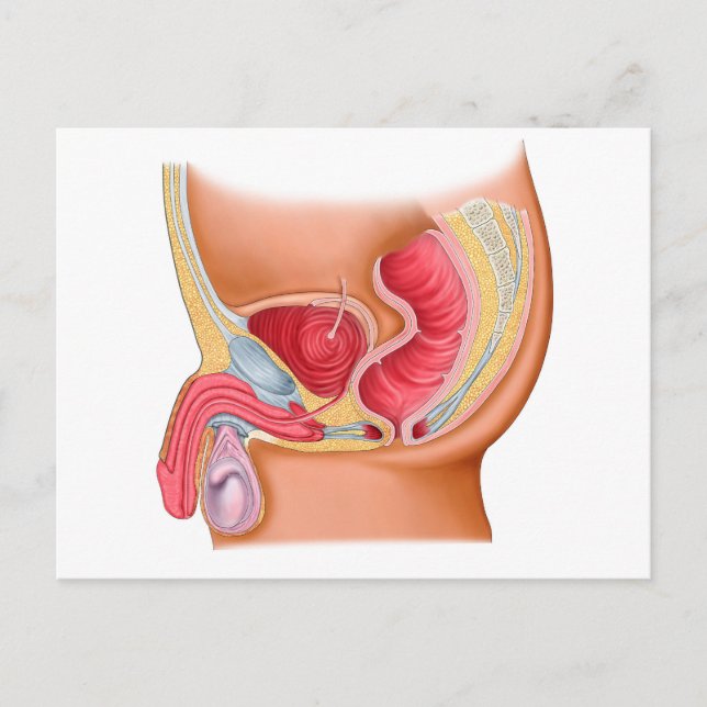 Medicinsk illustration av en Rectourethral Fistula Vykort (Framsida)