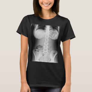 Medicinsk röntgenfoto - anatomi i människokroppen t shirt