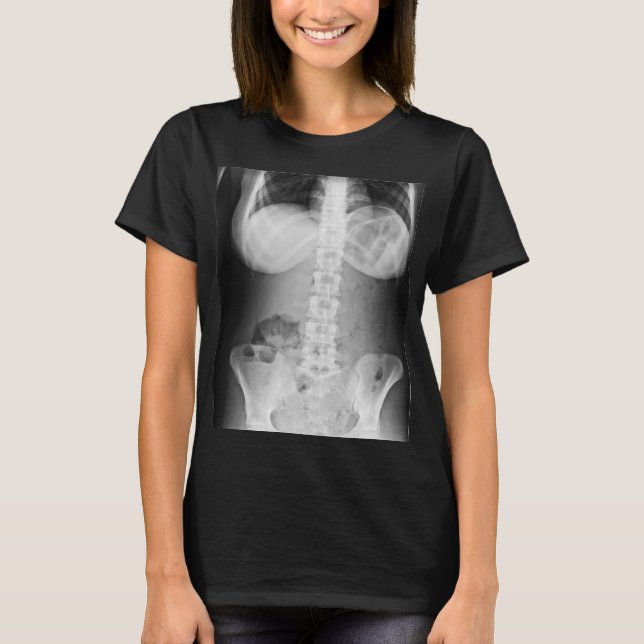 Medicinsk röntgenfoto - anatomi i människokroppen t shirt (Framsida)