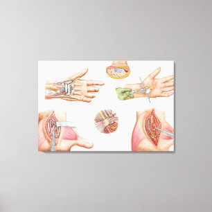 Medicinsk tunnel för illustrationvisningCarpal Canvastryck