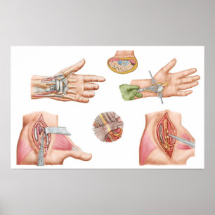 Medicinsk tunnel för illustrationvisningCarpal Poster