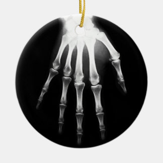 Medicinsk X-Ray Doktor-sjukhusvård X-Ray Hand Julgransprydnad Keramik