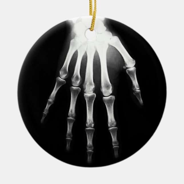 Medicinsk X-Ray Doktor-sjukhusvård X-Ray Hand Julgransprydnad Keramik (Framsidan)